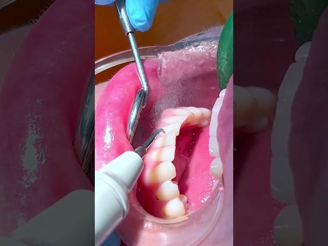 Teeth cleaning