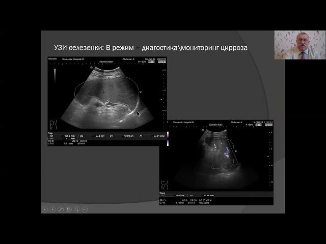 НАУЧНАЯ ШКОЛА «Лучевая диагностика в гастроэнтерологии». Часть 1