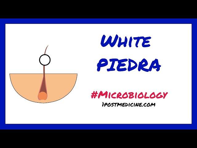 White Piedra // Microbiology