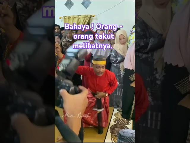 Hampir Buta Matanya Dicungkil