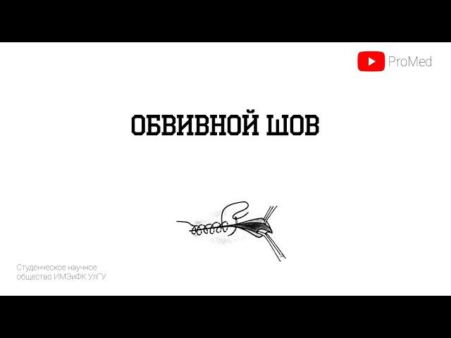 Непрерывный (обвивной) шов