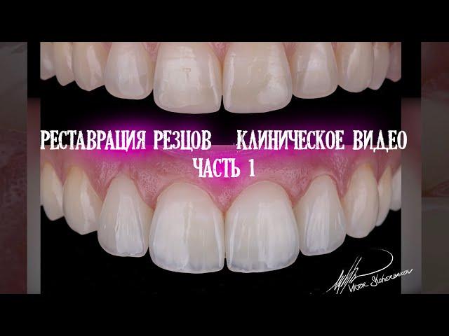 Реставрация фронтальных зубов. Клиническое видео. Часть 1