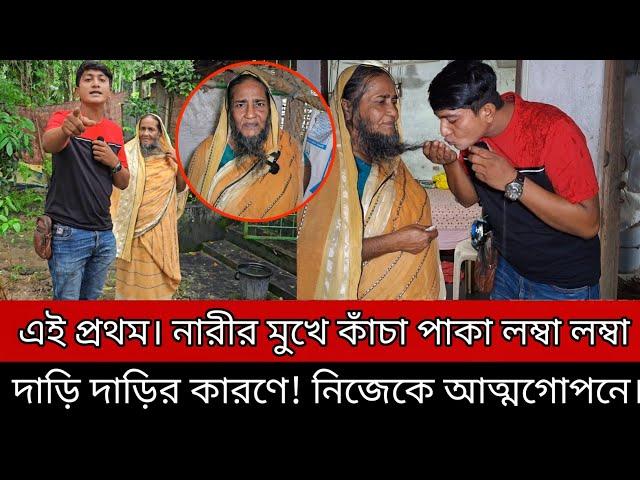 এই প্রথম। নারীর মুখে কাঁচা পাকা লম্বা লম্বা দাড়ি দাড়ির কারণে! নিজেকে আ'ত্ম"গো/"পনে রেখেছে ৩০ বছর।