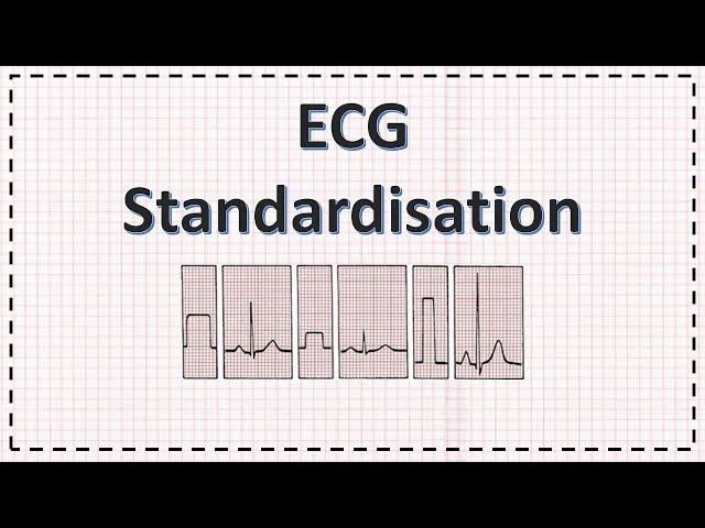 ECG Paper and Standardisation | ECG Interpretation Basics | Simplified Explanation