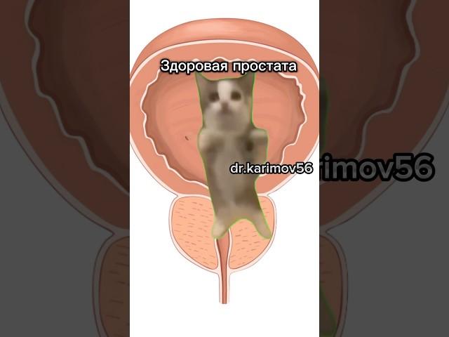 Лечение простатита#доктор #врач #уролог #каримов #аденома #простата #операция