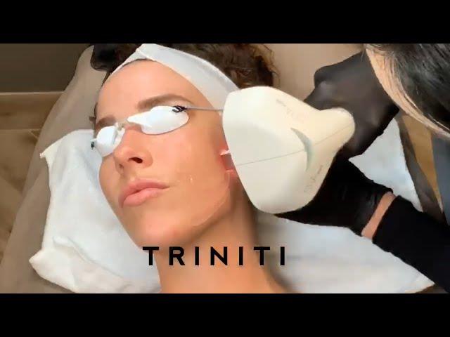 The Triniti Laser Series at It's A Secret Med Spa