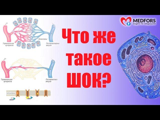 Что же такое ШОК?