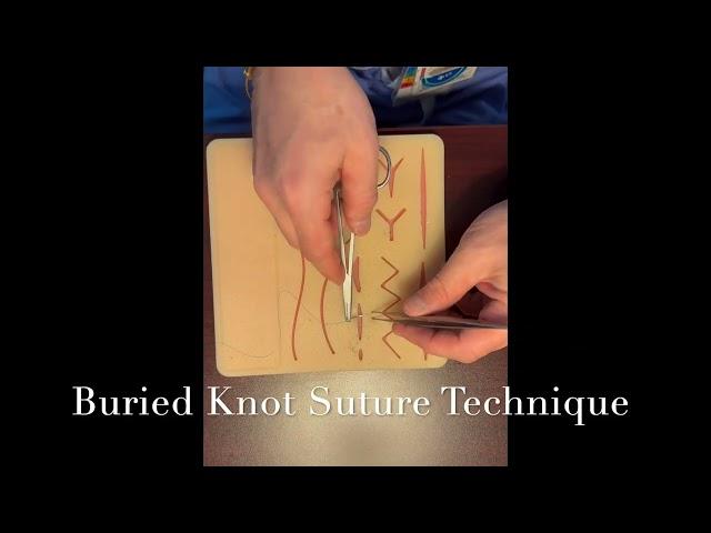 Buried Knot Technique Demo