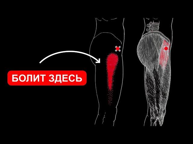 SURVIVE THE SIDE SURFACE OF THE HIP AND THE CELEBRED JOINT 