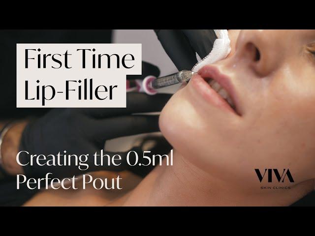 Getting Lip Fillers for the First Time   Everything You Need to Know about Lip Fillers