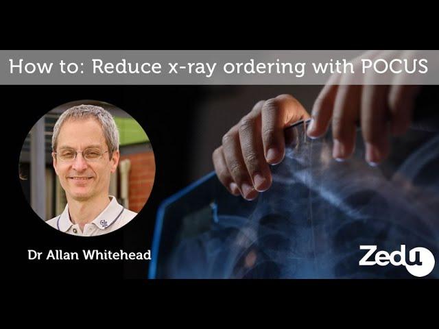 How to: Reduce x-ray ordering with ultrasound - Zedu POCUS Coaching Corner - 4 November 2021