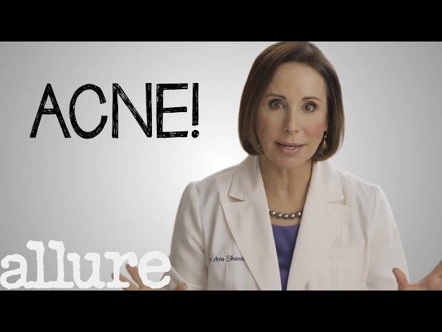 What is Acne and How Do I Get Rid of it Forever? | Allure