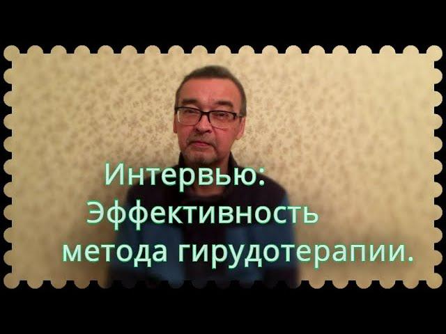 Интервью с доктором Лачковым  МВ об эффективности лечения гирудотерапией.