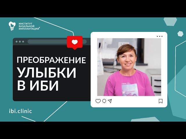 Отзыв пациента об имплантации зубов и протезировании в Институте Базальной Имплантации