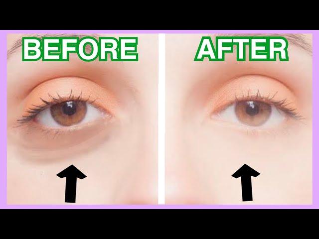 Massage to Remove Dark Circles Under Eyes & Sunken Eyes in 3 mins!