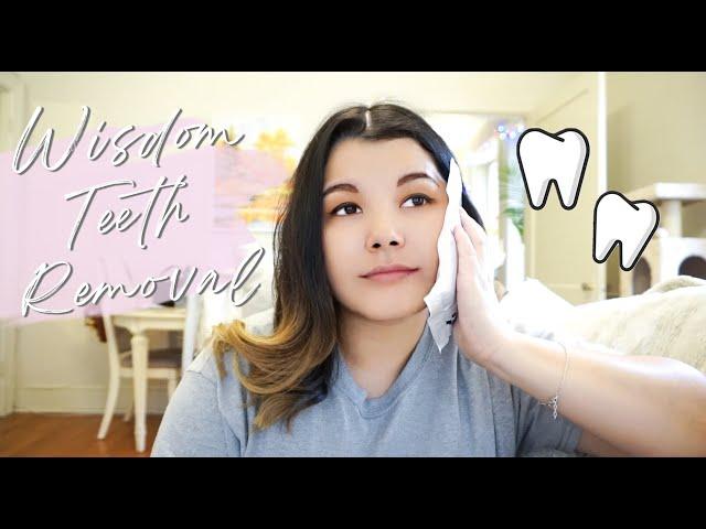 I Got My Wisdom Teeth Removed 