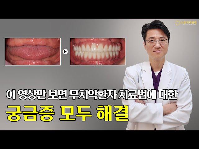 [부산전체임플란트] 이 영상만 보면 무치악 환자 치료법에 대한 궁금증 모두 해결 !