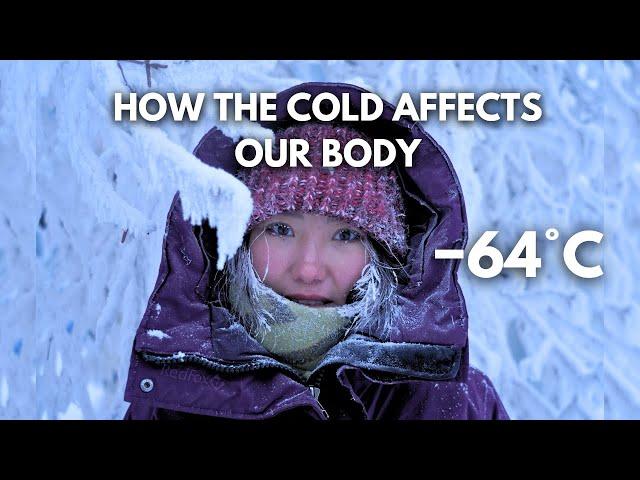 How Living in the World’s Coldest City Affects Our Body −64°C (−84°F)? Yakutsk, Siberia