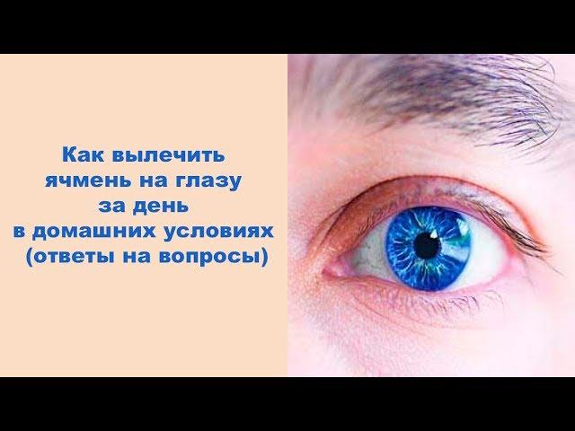 Как вылечить ячмень на глазу за день в домашних условиях ответы на вопросы