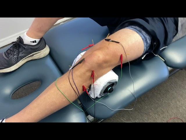 Example Of Electro DN For Knee OA | Orlando FL | Pursuit Physical Therapy