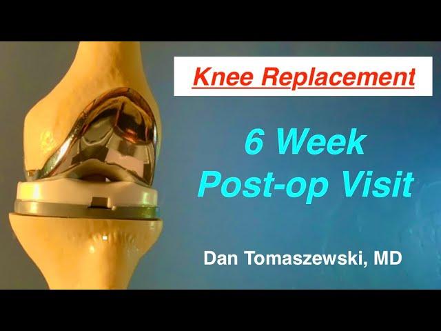 6 Week Post Op Visit after Knee Replacement