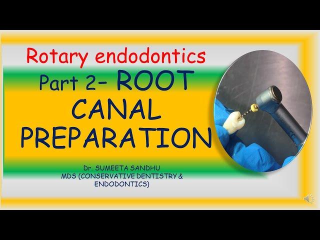 Root canal preparation with rotary flies| Rotary endodontics part 2| Rotary endo for beginners