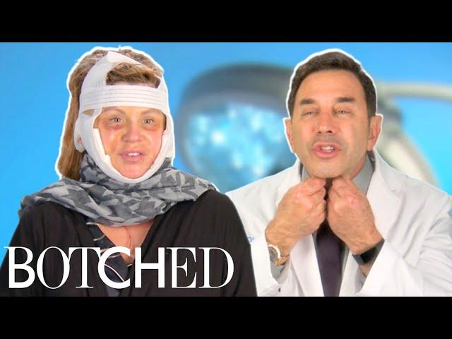 Dr. Nassif Fixes Lisa’s Facelift Gone Wrong FULL TRANSFORMATION | Botched | E!