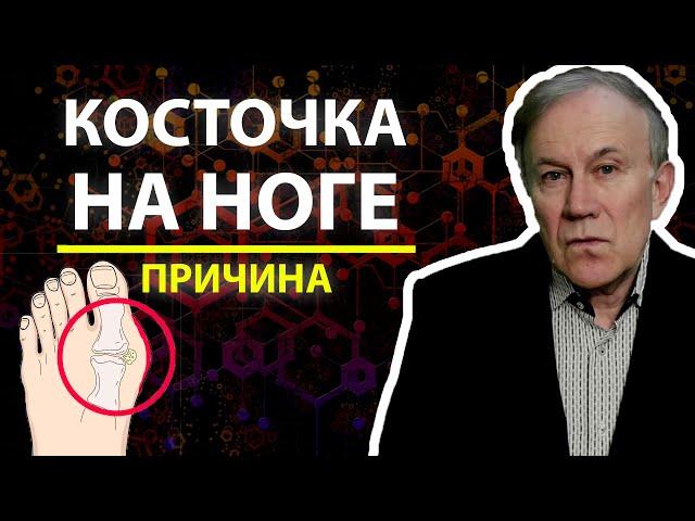 Косточка на ноге. Причина | Анатолий Донской | Энергия мысли