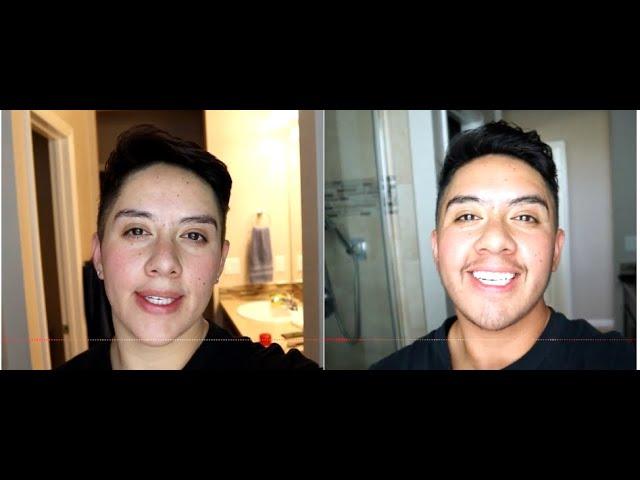 6 Months on Testosterone -  Voice Change #2023 #testosterone #ftm