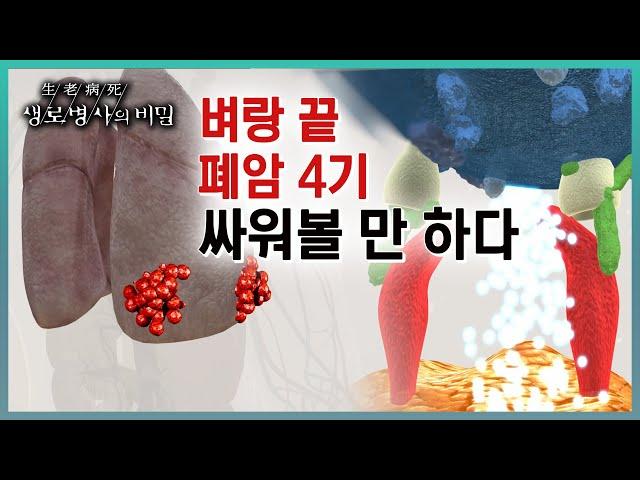 방송하이라이트흡연자의 암이라는 공식이 깨진 폐암의 원인과 치료법, 그리고 희망을 놓지 않은 사람들의 이야기 (KBS 20230719 방송)