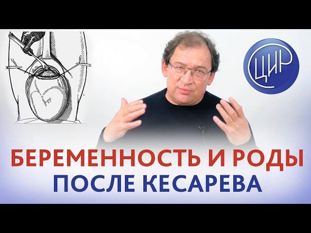 Беременность и роды после кесарева сечения. На что обратить внимание. Рассказывает Гузов И.И.