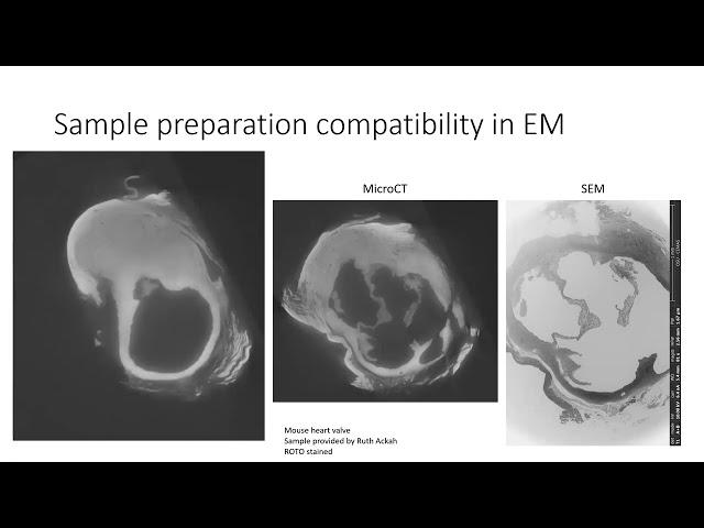 Using microCT in Conjunction with Electron Microscopy