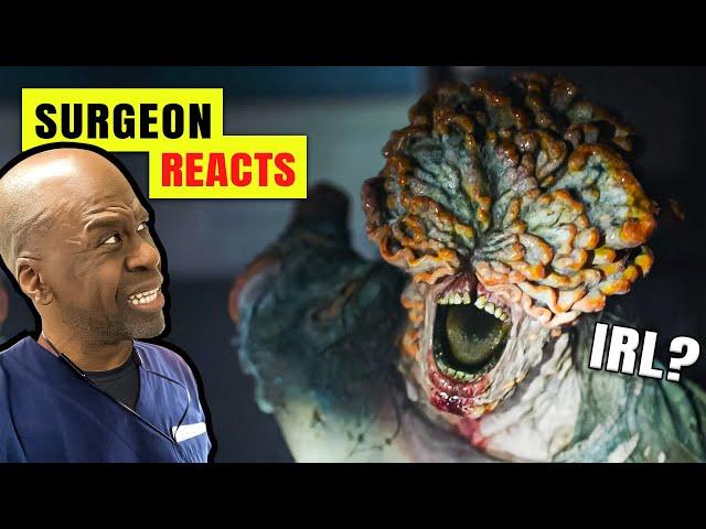 Could The Last Of Us Happen IRL? Surgeon Reacts To Cordyceps Infection & Zombie Fungus