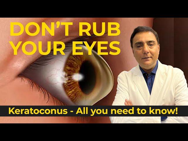 All you need to know about Keratoconus!