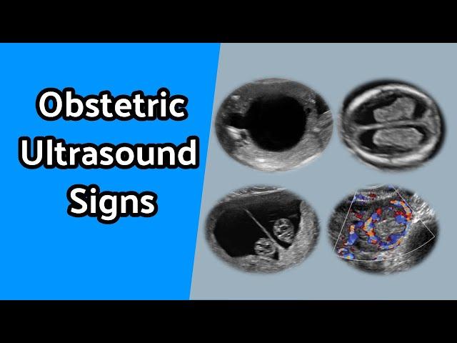 Obstetric Ultrasound Signs