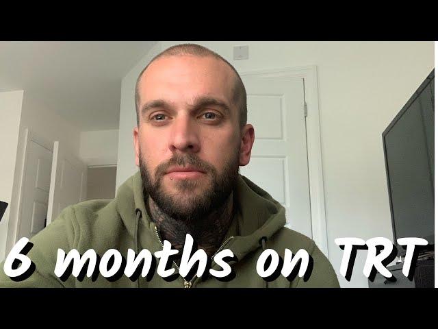 6 months on Testosterone Replacement Therapy. TRT UK. Masturbation?