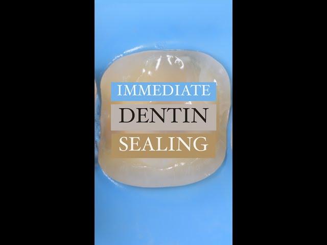 Immediate Dentin Sealing is necessary for biomimetic dentistry!