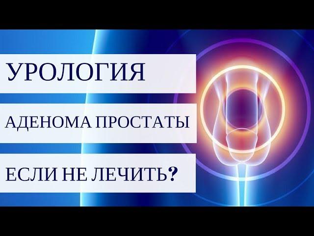 АДЕНОМА ПРОСТАТЫ - что будет, если не лечить?