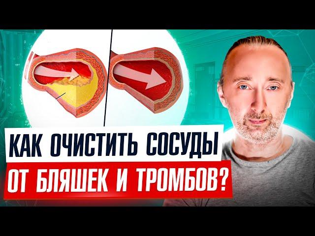 Только ТАК можно очистить СОСУДЫ от: холестерина, бляшек и тромбов! Вот и рецепт и план действий!