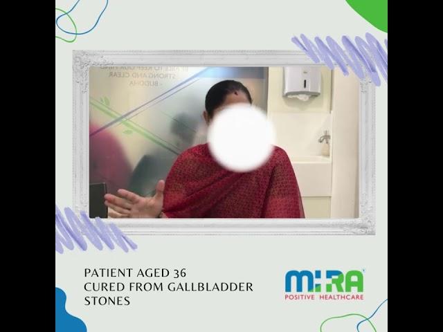 Patient Review | Gall Bladder Stones Surgery | MIRA HEALTH CARE | Dr.Vani Vijay | Testimonials