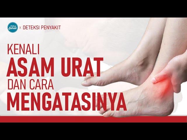 Asam Urat, Gejala dan Cara Pencegahannya! | Hidup Sehat tvOne