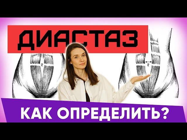 Диастaз: как определить. Диастaз что это такое. Диастаз после родов | Евгения Кузнецова тренер | 12+