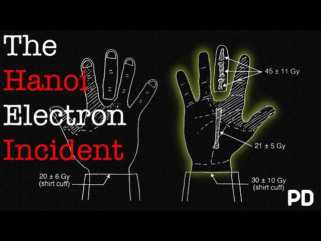 A Brief History of: The Hanoi Electron Accelerator Accident (Documentary)