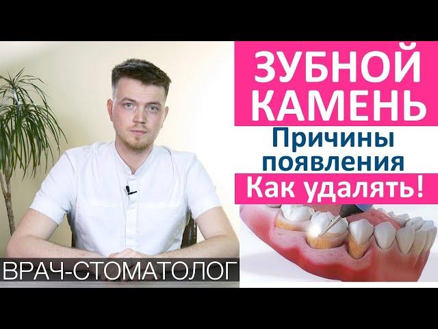 Зубной камень причины появления и как удалять. Как появляется зубные отложения из зубного налета.