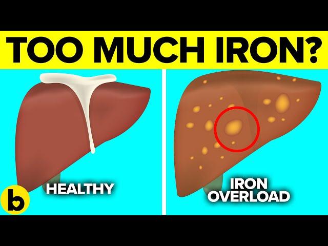 Signs of Too Much Iron In Your Body And Why It Is Harmful