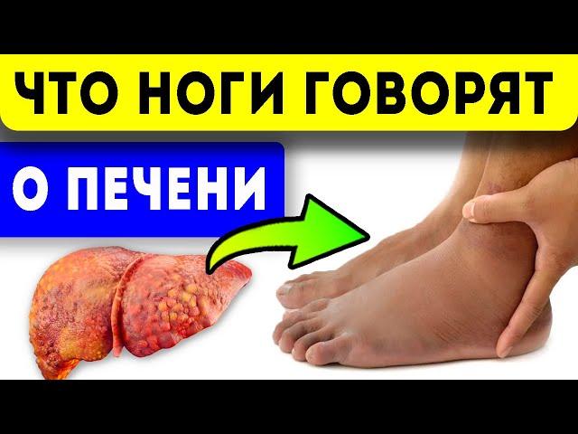 7 симптомов на ногах, которые расскажут о заболеваниях печени!