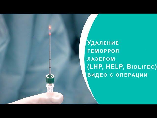 Удаление геморроя лазером (LHP, HELP, Biolitec) видео с операции