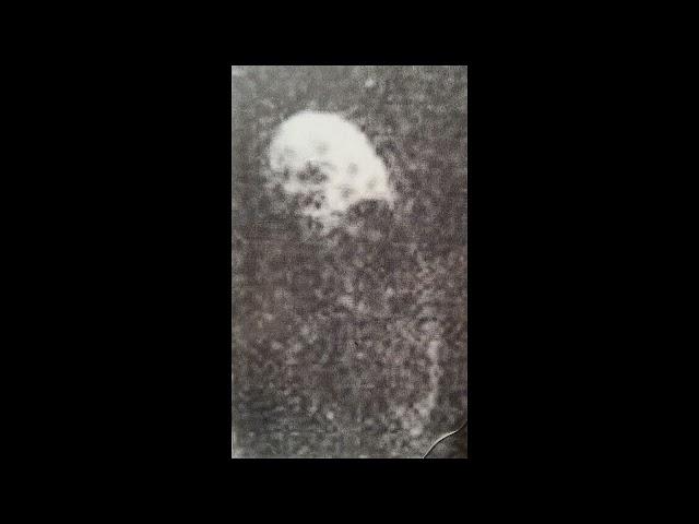 Xenoglossis (US) - Tergum Ambulare (Demo 2013)