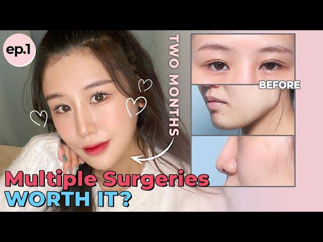 [SUB] Getting Multiple Procedures for a Proportionate and Smooth Facial Line in KOREA! | Contouring