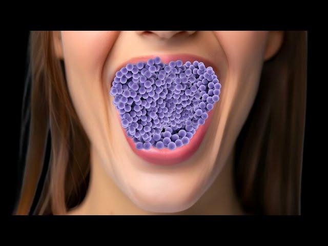 Burett Is Live ASMR Best experience Video maggots remove